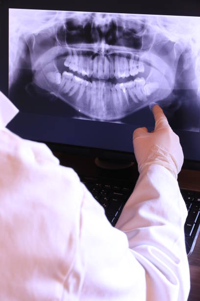 Best Emergency Tooth Extraction in New Burlington, OH