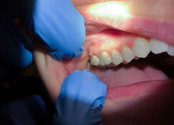Best Emergency Orthodontic Repairs in New Burlington, OH